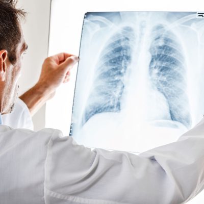 lung scans
